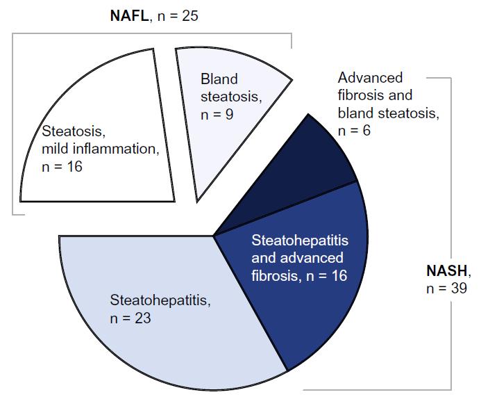 Progression from NAFL to NASH 70 NAFLD patients with repeat liver