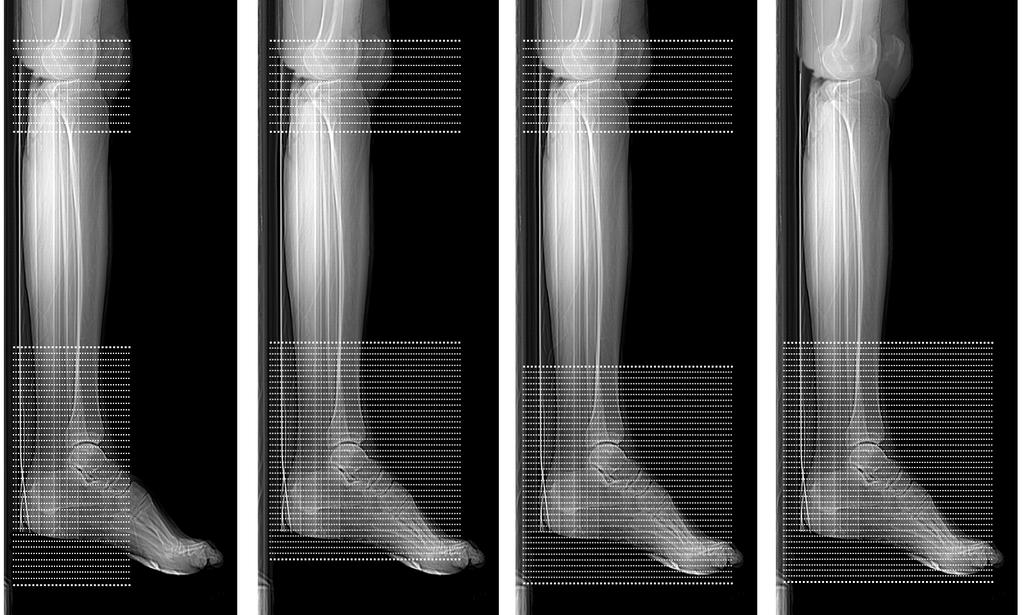 FIGURE 6 Failure to scan at least 10cm above the ankle joint.