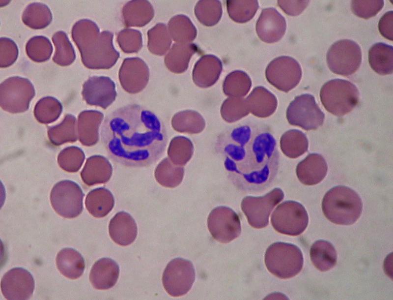 Neutrophils are the first responders of the body's defense system. Neutrophils rapidly localize to areas of acute infection and phagocytize bacteria.