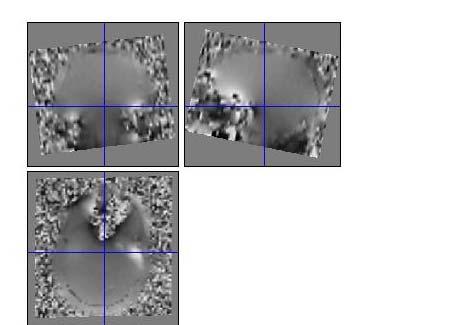Field Maps: The field map is a 2D gradient echo sequence which acquires an image at 2 different echo times. This sequence generates 2 types of images, a magnitude image and a phase map.
