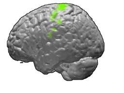 Motor and Visual Cortex Motor cortex - BA4 shown in green Visual cortex - BA 17,18,19 from rear view of brain BA 17 is shown in