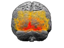 and you ll see bilateral visual cortex. Brain surface extracted from structural MRI data (Wellcome Dept.