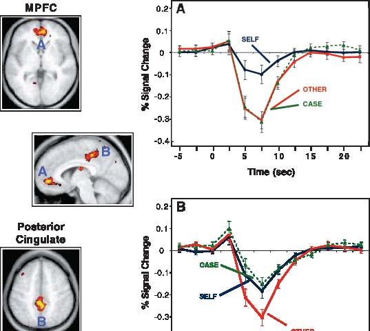 ACTIVATION FOR SELF-REFERENCE W. M. Kelley, C. N. Macrae, C. L. Wyland, S. Caglar, S. Inati, and T. F. Heatherton, "Finding the Self? An Event-Related fmri Study.