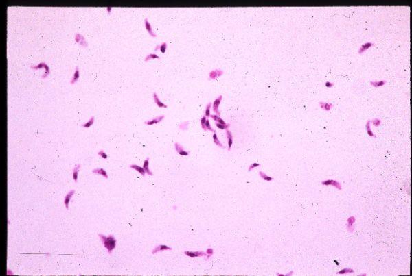Toxoplasmosis Mode of infection: - ingestion of cyst in raw meats - ingestion of oocyst (in cat