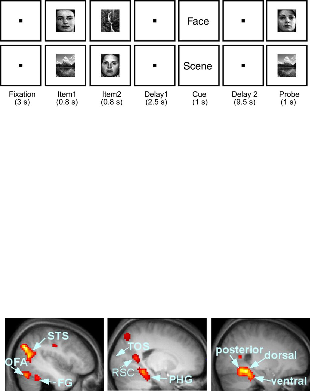 10 X. Han et al. / NeuroImage 73 (2013) 8 15 A B C Fig. 1. (A) Visual working memory task with a selection cue.