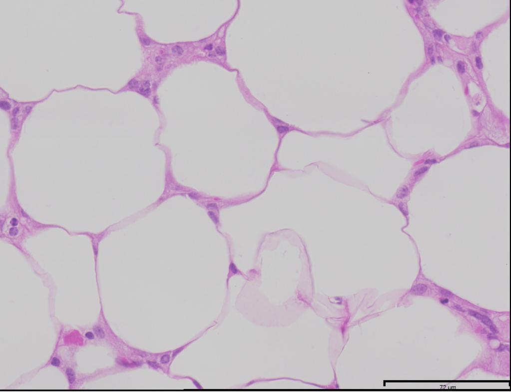 RS ET M ET M FD LF H LF D FD H 1 D Cross Sectional Area (um2) ewat Adipocyte Cell Size Figure 3.