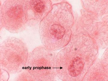 I. Prophase Chromosomes