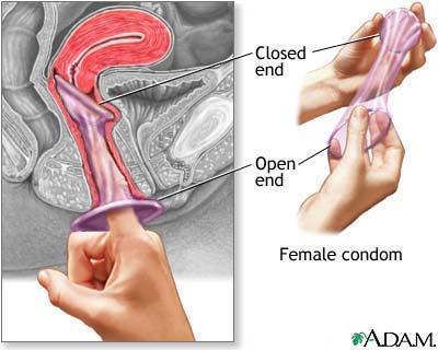 Female Condoms Can be controlled by the female Effective Expensive