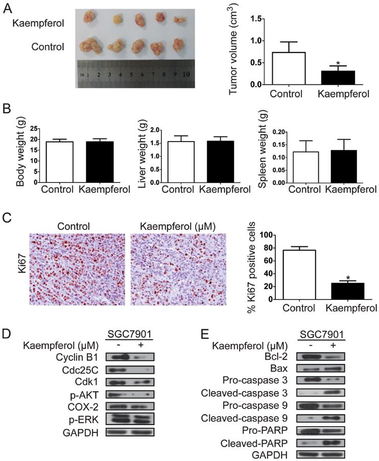 872 Figure 4. Kaempferol suppresses tumor growth in vivo.