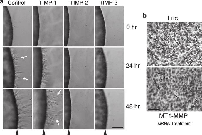 26 G.E. Davis et al. Fig. 2.2 MT1-MMP plays a critical role in EC sprouting in 3D collagen matrices from a monolayer surface in assays that mimic angiogenesis.