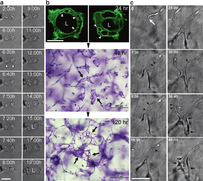 2 Molecular Control of Vascular Tube Morphogenesis and stabilization 21 Fig. 2.1 Temporal analysis of endothelial tube formation events in 3D collagen matrices during vasculogenesis and angiogenic sprouting.