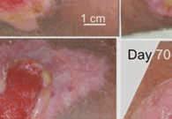 Healing progressed with continued moderate exudation, minimal maceration, and robust granulation (Figures 2, 3).