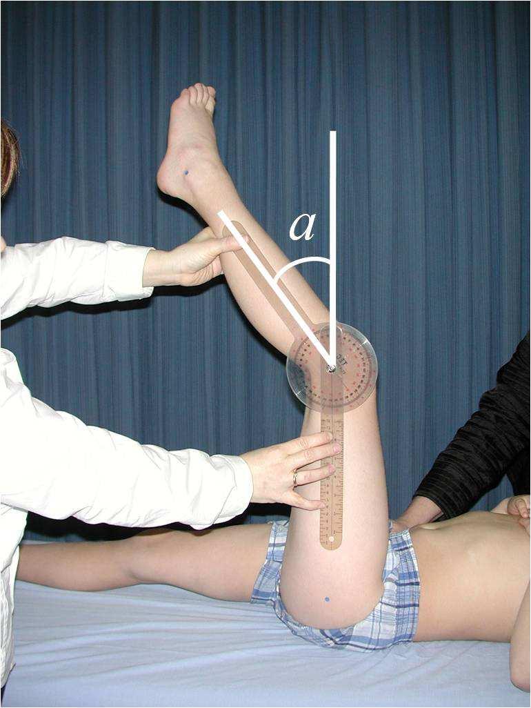 Part 4: Specific Tests 211 Testing Condition TABLE 4.14. POPLITEAL ANGLE The child has to be in a relaxed awake state.