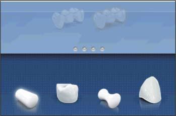 Sirona Dental Systems GmbH 8 Design examples Editing the attachment 1. Click on the bridge with the attachment in the object bar. 2. Move the mouse to the bottom edge of the screen. 3.