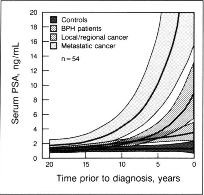 Note substantial increase in serum value years before local or regional cancer or metastatic cancer was diagnosed. BPH=benign prostatic hyperplasia. (From Carter and associates.