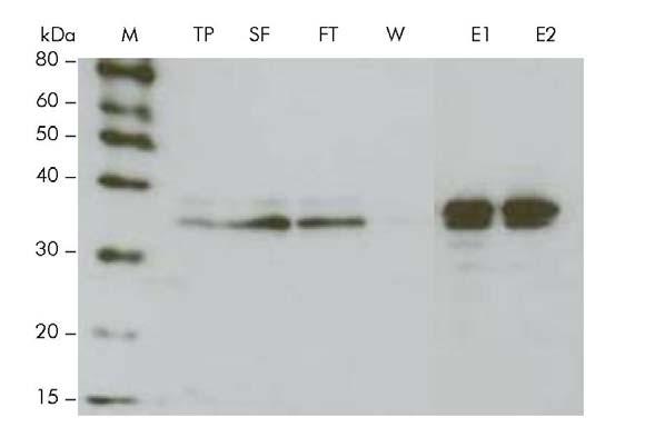 The cell membranes were resuspended in the indicated detergents (supplied in the Ni-NTA Membrane Protein Kit). Aliquots of the total protein fraction were taken for SDS-PAGE and Western analysis.