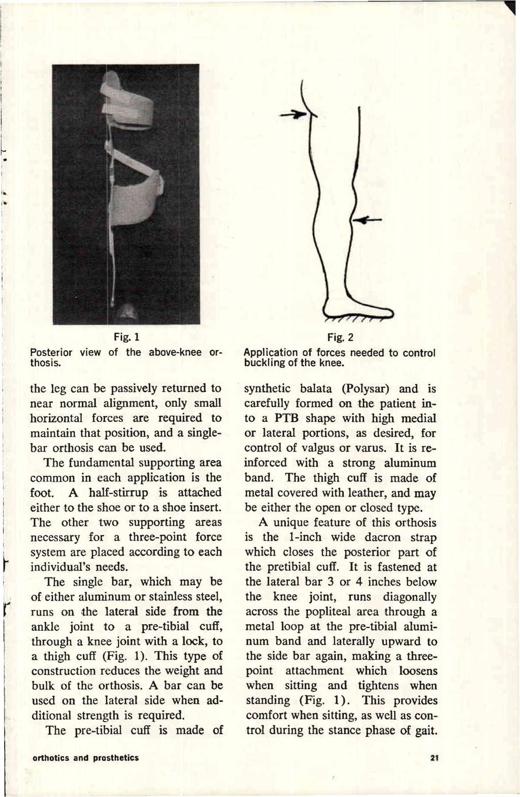 Fig. 1 Posterior view of the above-knee orthosis.
