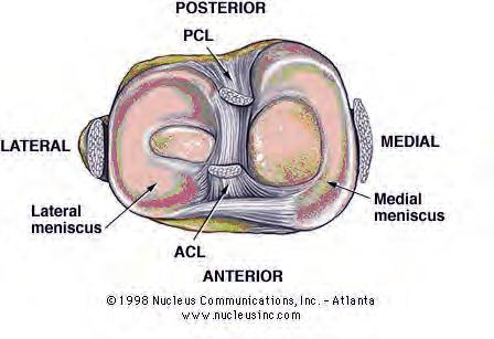 The medial collateral ligament (MCL) connects the femur to the tibia while the lateral collateral ligament (LCL) connects the femur and fibula (Figures 1 and 2).