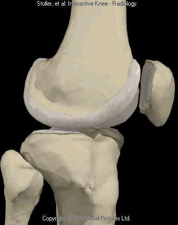 The Knee: Introduction 3 bones: femur, tibia and patella 2 separate joints: tibiofemoral and patellofemoral. Function: i.