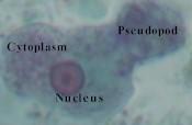 What to look for Cyst Glycogen vacuoles