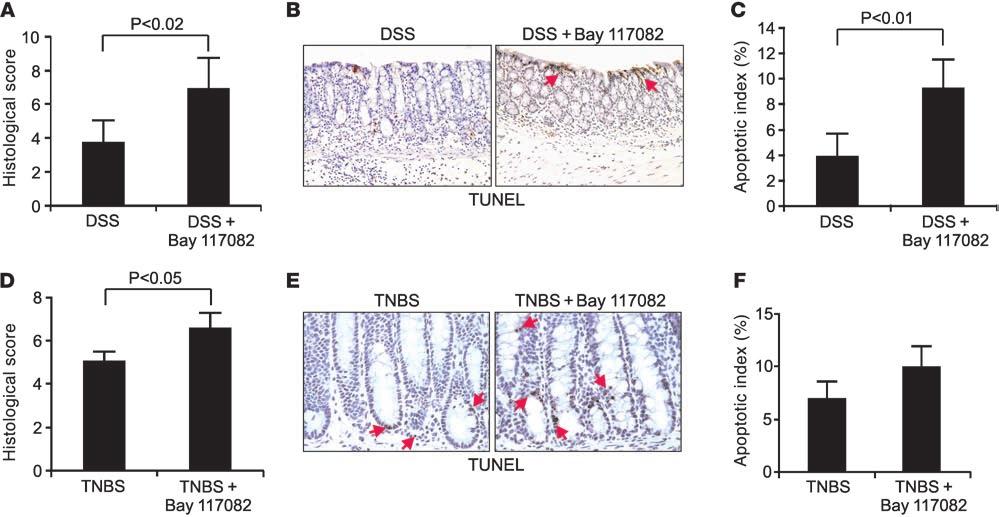 Figure 9 Effects of NF-κB inhibition on DSS- or TNBS-induced colitis. (A) WT mice were treated with 5% DSS, alone or in combination with 8 mg/kg of the NF-κB inhibitor Bay 117082, for 7 days.