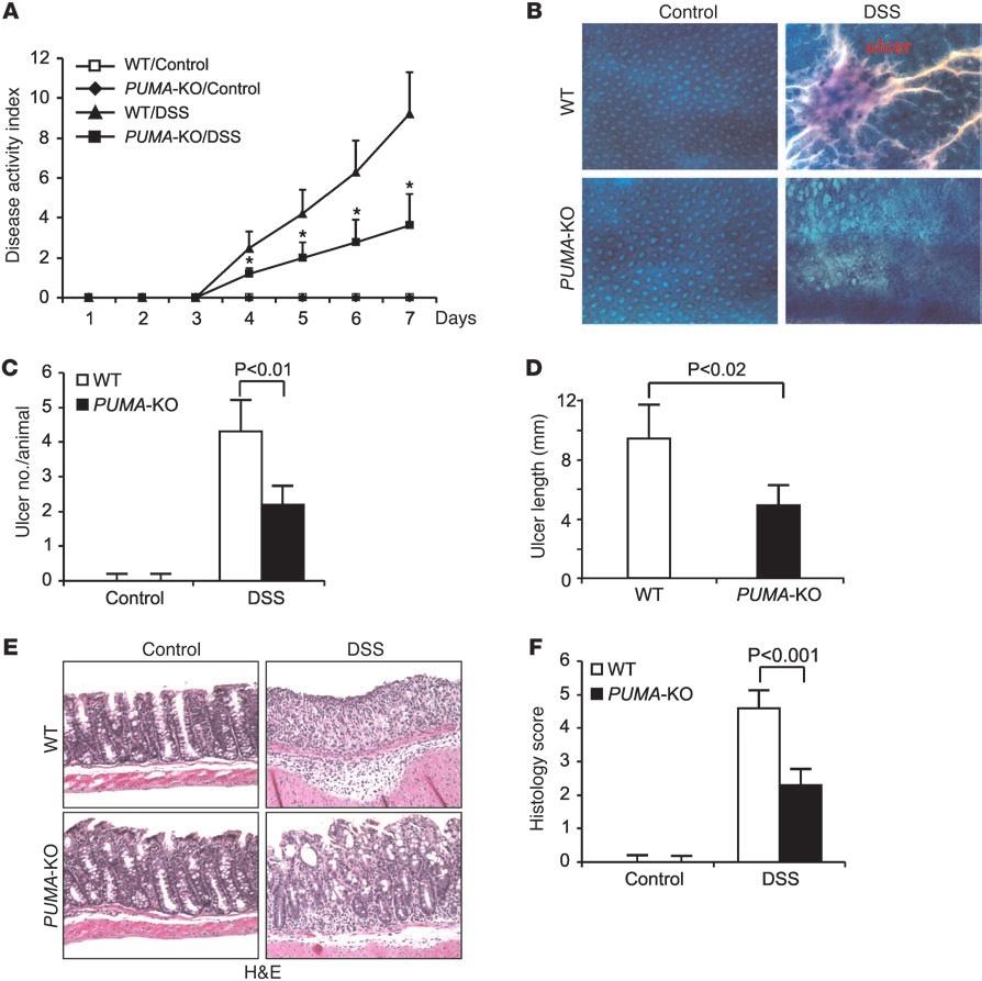Figure 3 Suppression of DSS-induced colitis in PUMA-KO mice. WT and PUMA-KO mice were treated with 5% DSS to induce colitis.