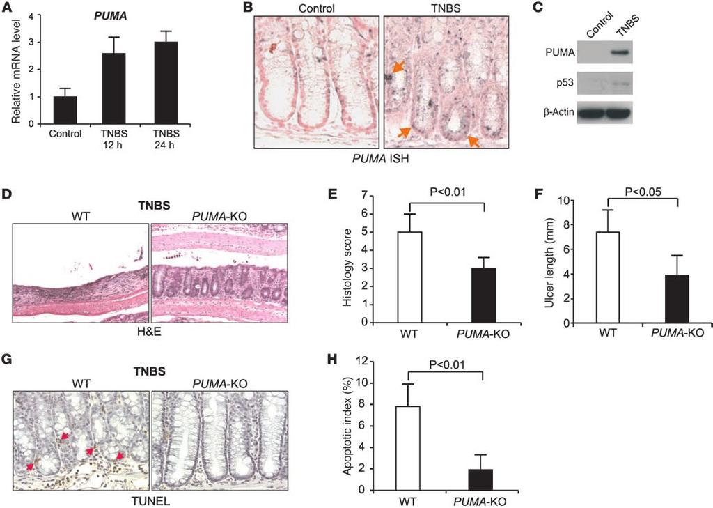 Figure 5 TNBS-induced and PUMA-dependent colitis. WT and PUMA-KO mice were treated with 100 mg/kg of TNBS to induce colitis.