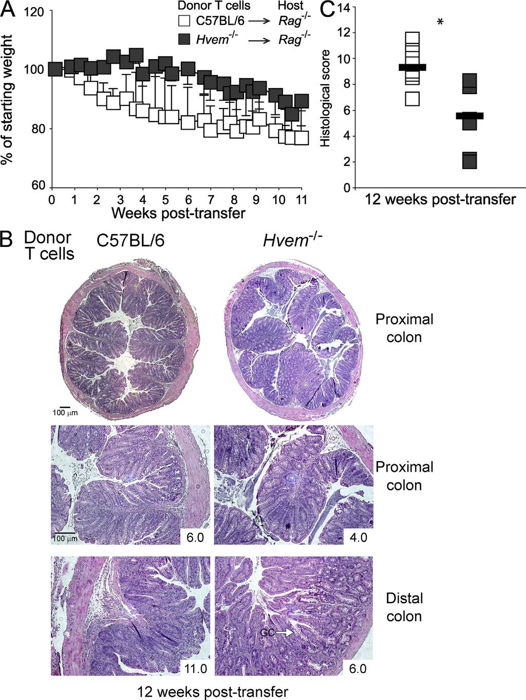 Published June 2, 2008 RESULTS The role of HVEM expression by T cells in colitis induction To investigate the participation of HVEM in colitis pathogenesis, we used an experimental mouse model
