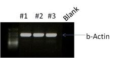 Beads immunocaptured exosomes #1 #2 #3 Blank Figure 3: RT-PCR analysis of total exosomal RNA derived from exosomes