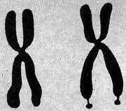 Fragile X Syndrome It is caused by a dynamic mutation in the gene FMR1 (Fragile Mental Retardation), located on the longer arm of X chromosome, that appears to be