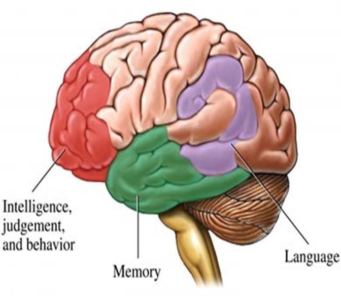 It is important to understand which part of the brain is affected by dementia, as this will indicate which