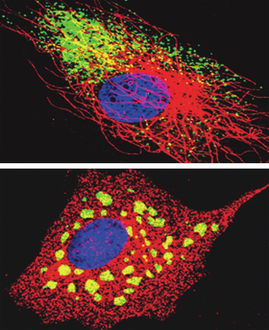 Movement of VSV nucleocapsids in cytoplasm requires microtubules uclei