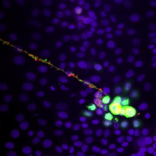 Polarized spread of infec3on by an alpha herpesvirus: Release from axon terminals and infec3on of