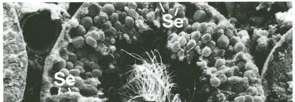 (Sertoli cells) (Tangle of tails) (Spermatocyte)