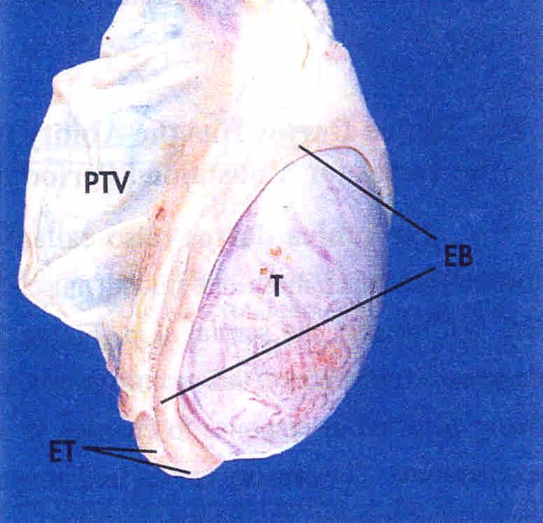 Epididymal tail PTV: Parietal tunica vaginalis T: