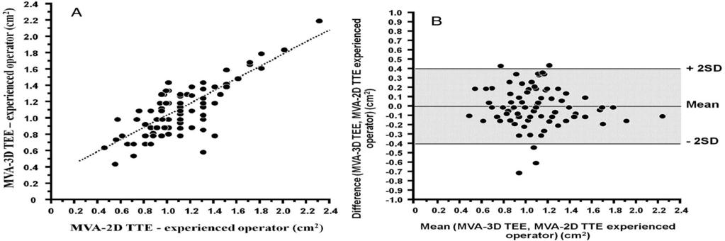 Correlation between MVA measured using 2D-TTE and real-time