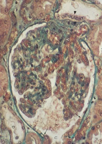Nephron Renal corpuscle 1 Glomerulus tuft of