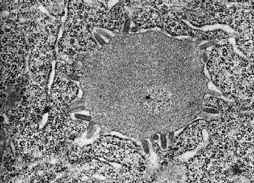 Rabies virus Negri body Electron micrograph of rabies virus in brain