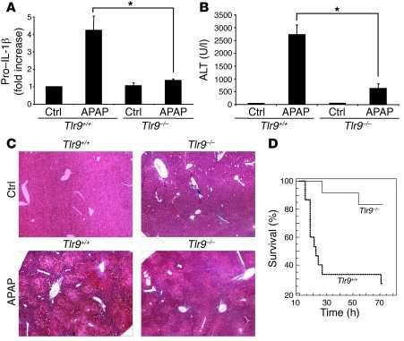 Paracetamol-induced hepatotoxicity and TLR-9 TLR-9 deficient mice have less IL-1β activation, less ALT and better