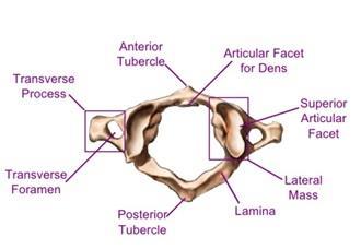 Figure 2.12. Spinous processes connected by interspinous ligament. Figure 2.13. Transverse process of cervical vertebra. From Atlas-C1 vertebra, by The art of medicine, 2015, https://theartofmed.