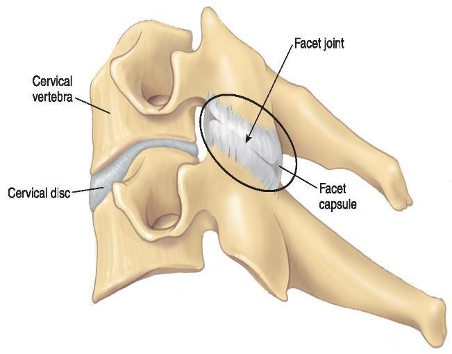 Figure 2.15. Facet joint. From Spinal facet joint, by Berovic, M. 2015, http://www.claphamsportsmassage.com/spinal-pain-what-is-it/. Copyright 2015 by Berovic, M. 2.2.4 Intervertebral Disc The intervertebral disc is a soft tissue that lies between each two adjacent vertebrae.