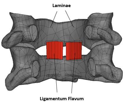 Ligamentum flavum: a long thick band of fibers made up from two lateral parts that run from axis down to the sacrum spine.