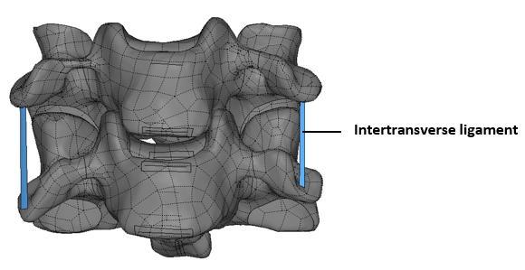 Intertransverse ligament: small straps of fibers that exist between transverse processes of vertebrae. They are disconnected at each vertebra.