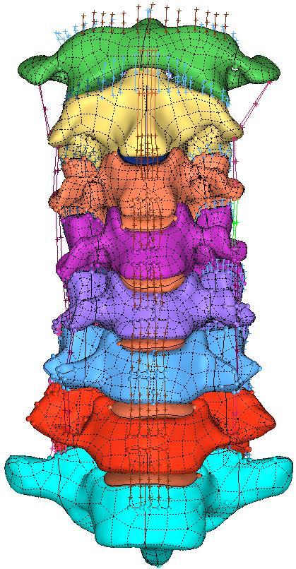 Figure 4.1. Showing the raw state of the model, without skull (C0). Bony structures were imported from CT scans. Mimics software was used to create and clean the geometry of the vertebrae.