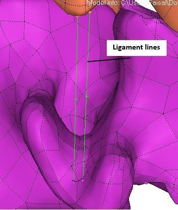 Figure 4.3. a) Ligament lines b) Ligament surface. Once all the ligaments were created, intervertebral discs were to be modeled next.