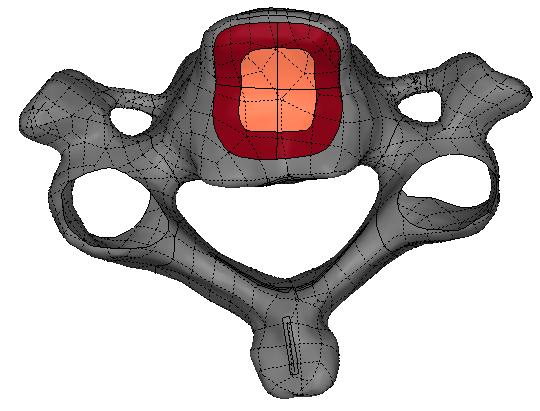Once the end-plate areas were established, they were divided into two regions, nucleus and annulus. Pooni et al.