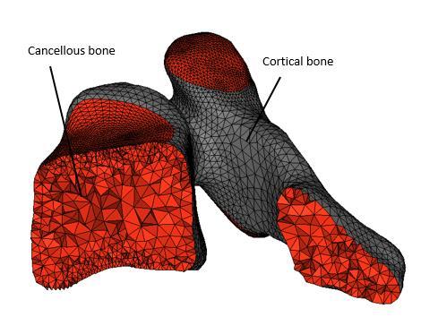 Vertebrae are made up of two types of osseous tissues. Cortical bone is the outer surface while cancellous bone is the soft and flexible inside part.