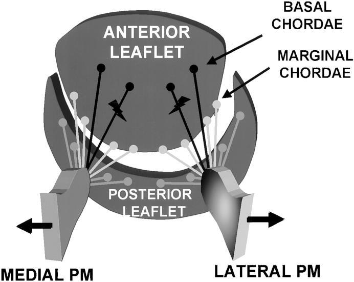 shape of the leaflet scallop Mitral Valve Chordal Anatomy aka secondary chordae