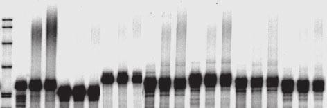 Substrates were incubated with ( ) or without ( ) purified SR proteins for 30 min and were subjected to electrophoresis on a 6% polyacrylamide gel that contains 8 M urea.