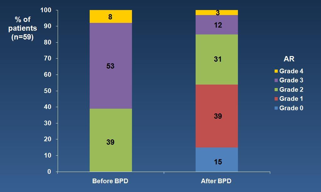Impact of Balloon Post-dilation on PVR And Outcomes PD: 2.